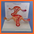 Human Size Female Uterus Ovary Anatomy Model Showing Common Pathologies